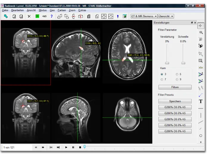 News 57 befundung und betrachtung